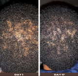 DEEP ROOTS - Ayurvedic Hair/Beard Growth Oil